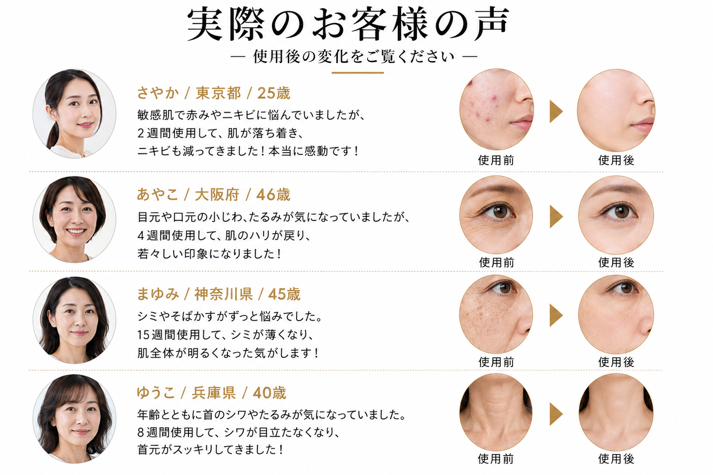 【満足度No.1】VELARIS N°1™ EMS・RF・LED搭載｜ハリ・ツヤ・毛穴ケア・自宅サロン美顔器